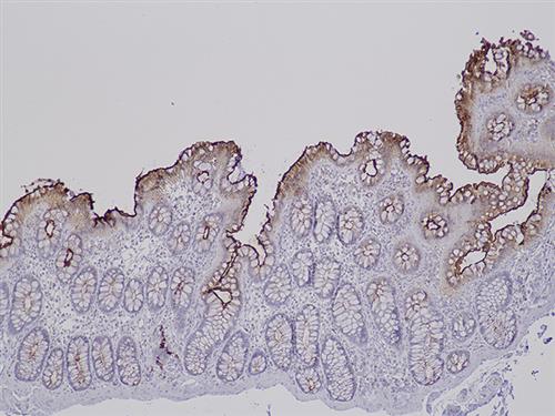 3160B | Control Slides:Immunopathology; Carcinoembryonic Antigen (CEA)